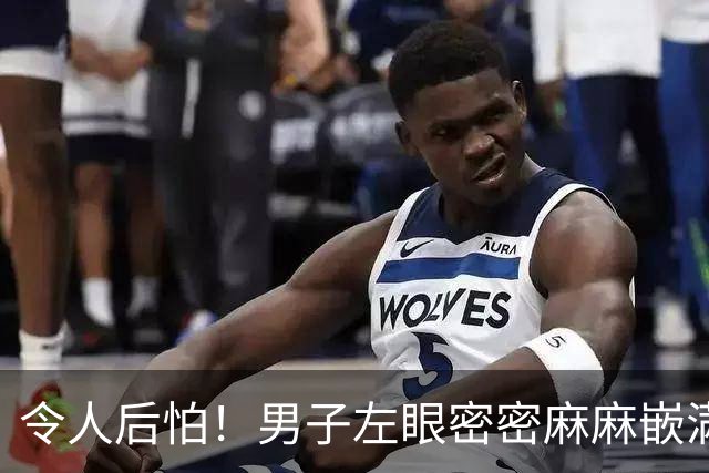 令人后怕！男子左眼密密麻麻嵌满近百根倒刺，上海医院凌晨接诊，近期频发！